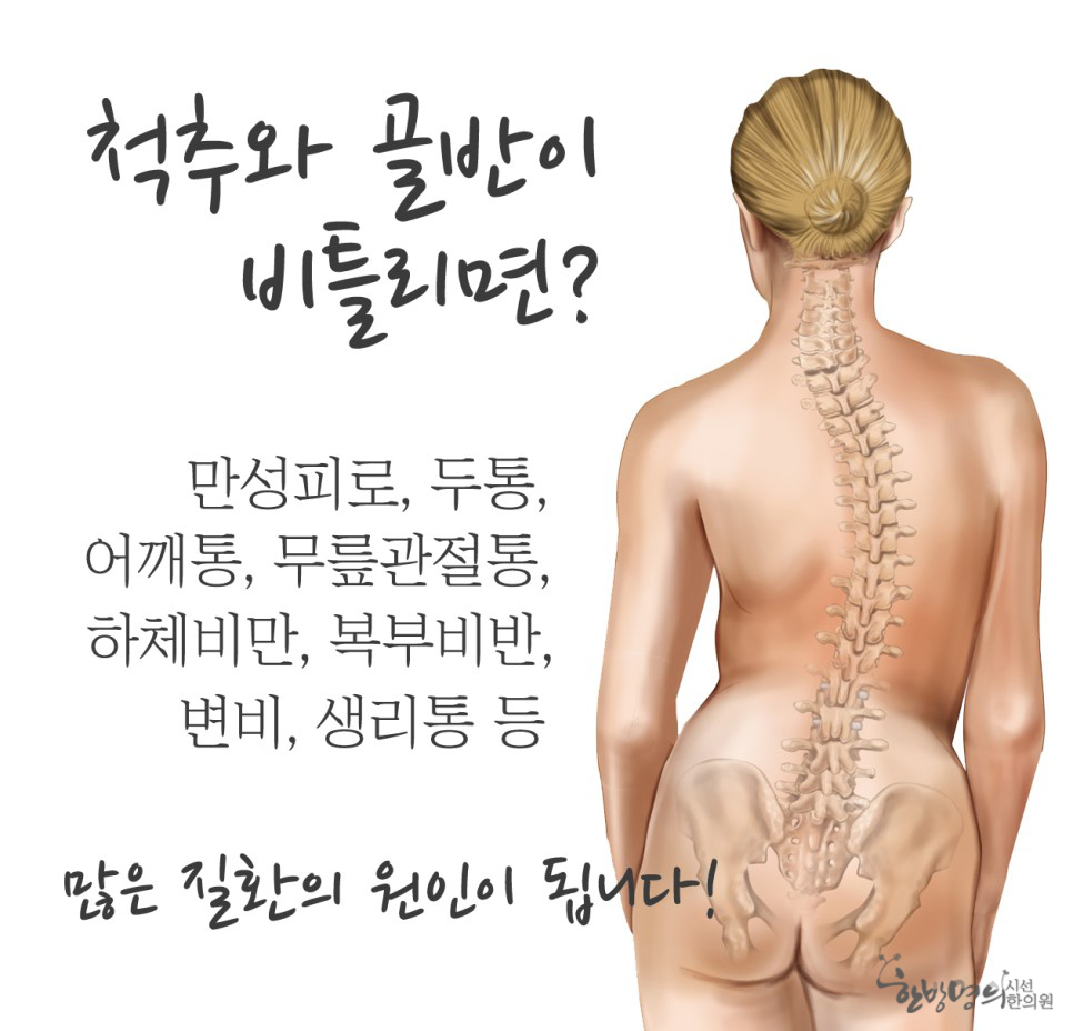 , 틀어진 뼈, 수축된 근육, 관절의 비틀림등을 정상적인 위치로 환원하여 인체의 긴경력을 회복함으로써 통증완화, 순환촉진을 시키고 ... | SEASUN Korean Medicine Clinic